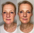 Load image into Gallery viewer, Anti-Aging HIFU, EMS and Microcurrent
